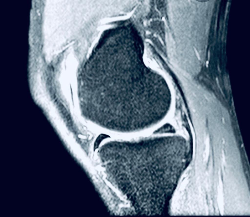 Trattamento conservativo gonalgia