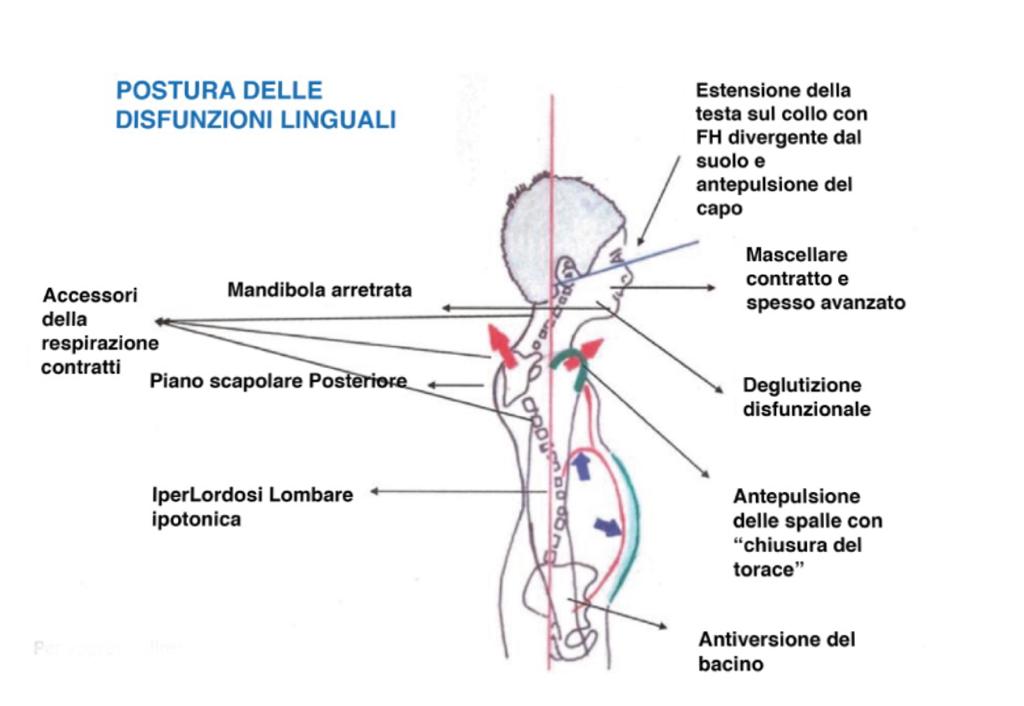 Dolore e limitazione funzionale del rachide cervicale in paziente