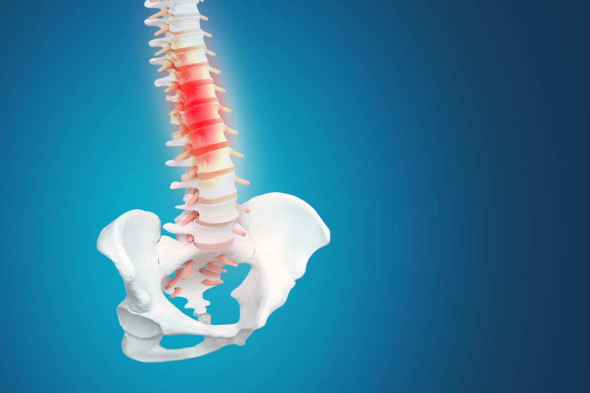 Che cos’è un crollo vertebrale e quali sono i benefici della fisioterapia