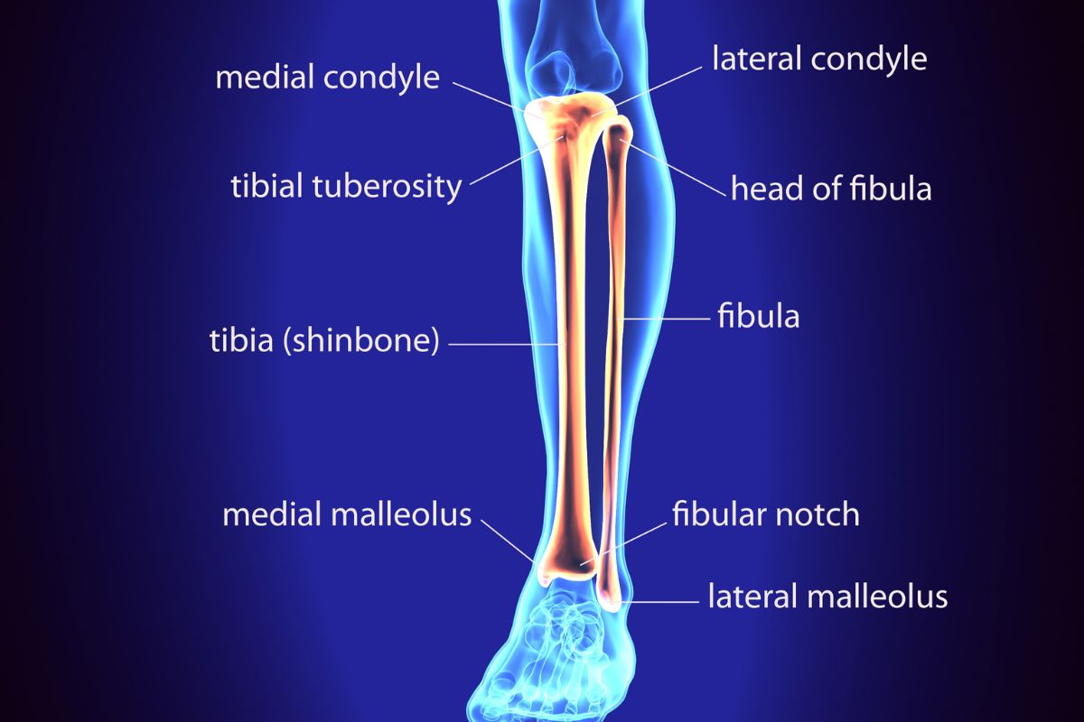 Frattura tibia e perone: la riabilitazione e i tempi di recupero